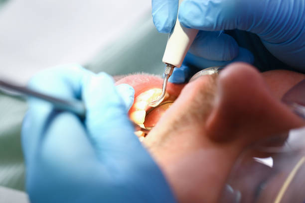 Best After-Hours Dental Trauma Care in Middletown, VA